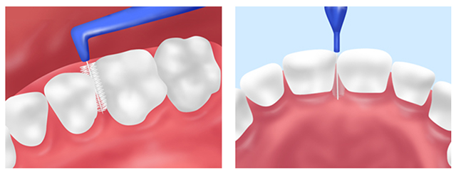 歯間ブラシ